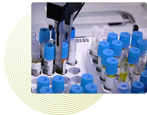 Photo shows blue-topped sample tubes in an analyzer with text beside it that says HIT results. Light green rings are artistically placed behind the photo.